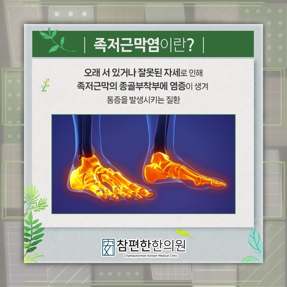 족저근막염 회복을 돕는 휴식과 비수술적 관리